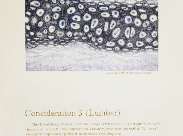 Time out of (skeletal) Joint: The Spineless don't Protest - Consideration 3