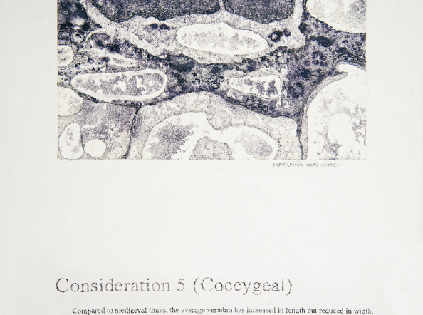 Time out of (skeletal) Joint: The Spineless don't Protest - Consideration 5