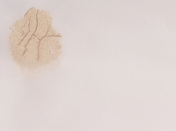 ' ...that one spot scars me II'