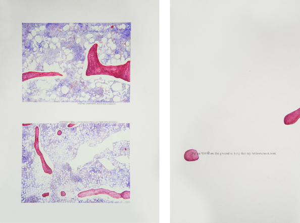 Time out of (skeletal) Joint: The Spineless don't Protest - Consideration 0