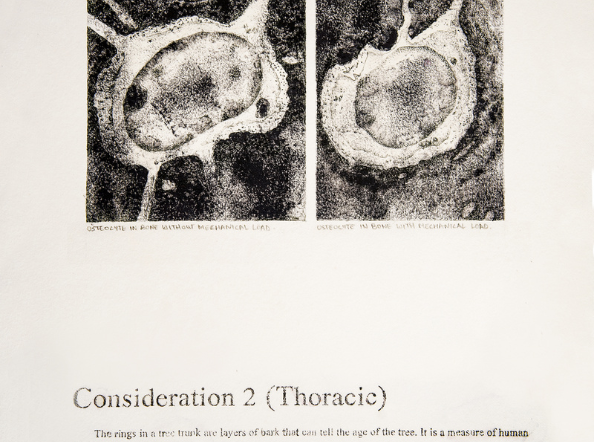Time out of (skeletal) Joint: The Spineless don't Protest - Consideration 2